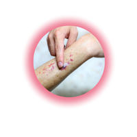 Poor red blood cell health