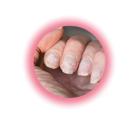 Low iron level or deficenncy