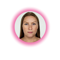 Dull And Uneven Skin Tone 